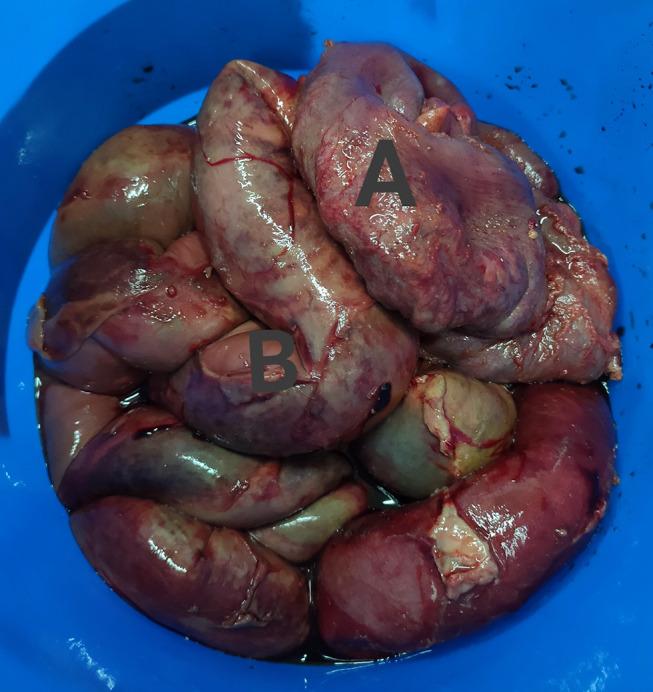 https://cdn.ncbi.nlm.nih.gov/pmc/blobs/fba9/7701158/0a1ae7675a39/IJGM-13-1265-g0003.jpg