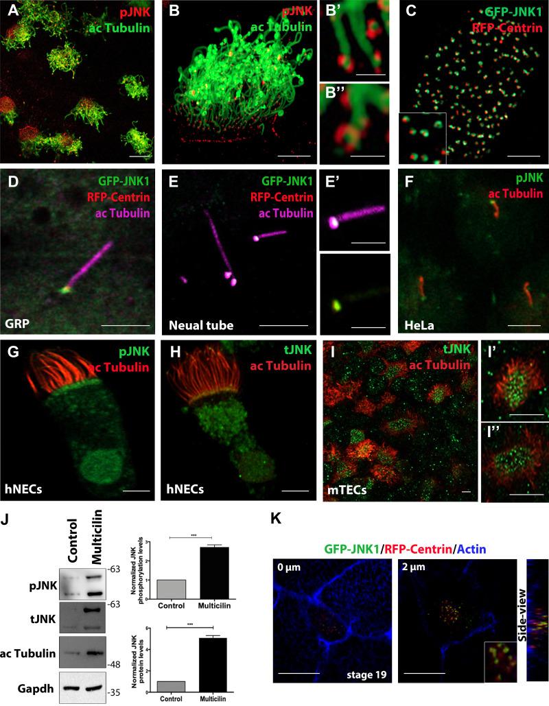 https://cdn.ncbi.nlm.nih.gov/pmc/blobs/fbb4/10585068/d4ad9e94429c/JCB_202303052_Fig1.jpg
