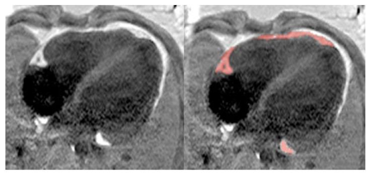 https://cdn.ncbi.nlm.nih.gov/pmc/blobs/fbb5/11678636/310e40541d63/jcdd-11-00383-g001.jpg