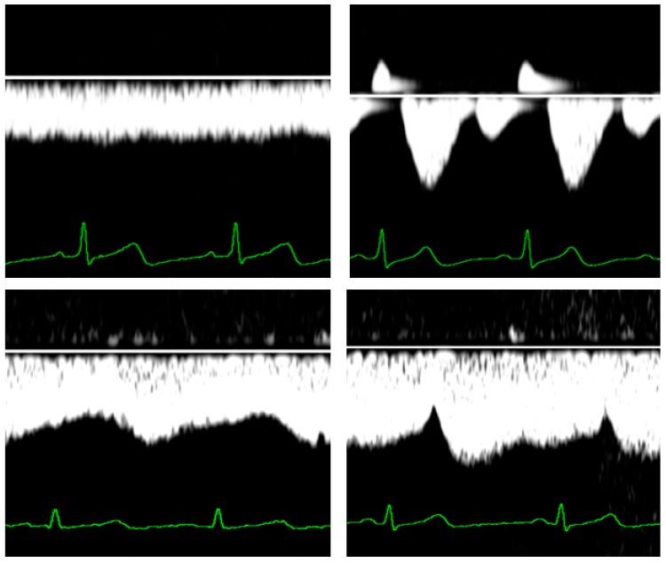 https://cdn.ncbi.nlm.nih.gov/pmc/blobs/fbb6/6462953/20709ae6daec/jcm-08-00335-g002.jpg