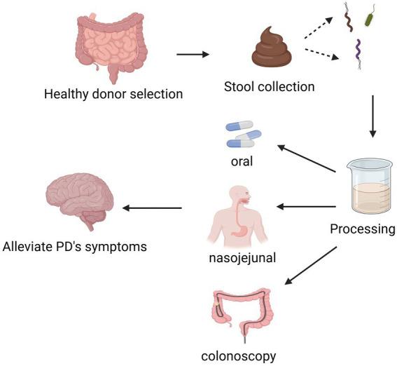 https://cdn.ncbi.nlm.nih.gov/pmc/blobs/fbb7/12405258/e73b59647f4a/fnins-19-1639911-g003.jpg