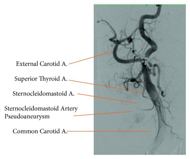 https://cdn.ncbi.nlm.nih.gov/pmc/blobs/fbb7/6199854/1b0a1d9ed167/CRIOT2018-8324908.002.jpg