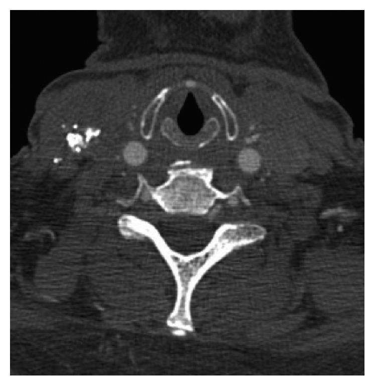 https://cdn.ncbi.nlm.nih.gov/pmc/blobs/fbb7/6199854/5261a66d820b/CRIOT2018-8324908.003.jpg