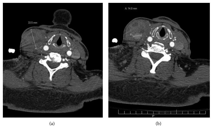 https://cdn.ncbi.nlm.nih.gov/pmc/blobs/fbb7/6199854/7915672fd557/CRIOT2018-8324908.001.jpg