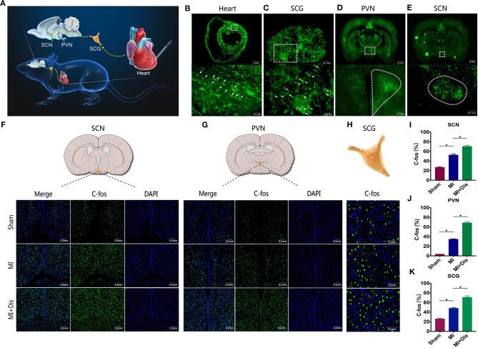 https://cdn.ncbi.nlm.nih.gov/pmc/blobs/fbb9/8032890/9bfb282f245d/fcvm-08-668387-g0003.jpg