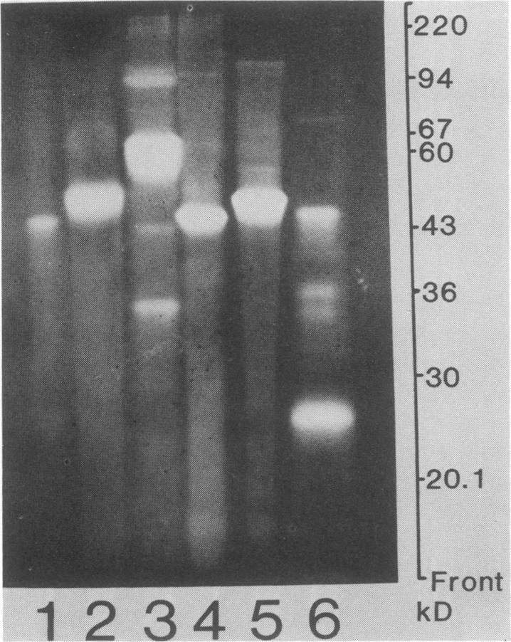 https://cdn.ncbi.nlm.nih.gov/pmc/blobs/fbbf/260221/8cf32bd4cf0e/iai00099-0076-c.jpg