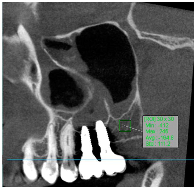https://cdn.ncbi.nlm.nih.gov/pmc/blobs/fbc0/11354878/f6894bf739eb/jcm-13-04638-g004.jpg