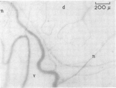 https://cdn.ncbi.nlm.nih.gov/pmc/blobs/fbc0/495431/dc7c0c6c7600/jnnpsyc00266-0044-a.jpg