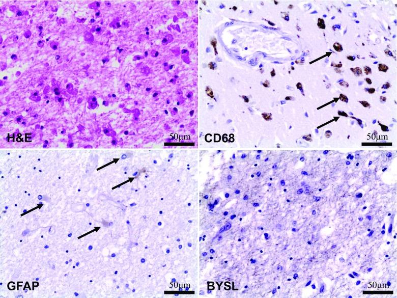 https://cdn.ncbi.nlm.nih.gov/pmc/blobs/fbc1/5830468/1ce154d5692f/12024_2017_9942_Fig2_HTML.jpg