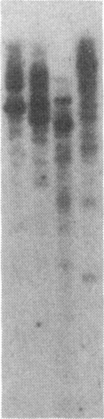 https://cdn.ncbi.nlm.nih.gov/pmc/blobs/fbc5/286822/bc0c07cf1ecc/pnas00246-0218-a.jpg
