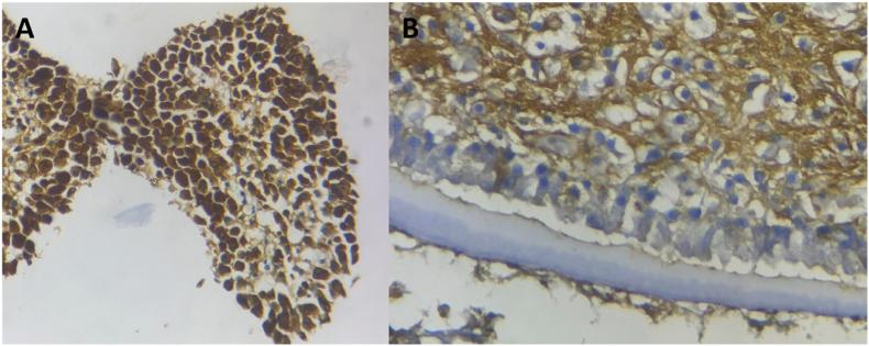 https://cdn.ncbi.nlm.nih.gov/pmc/blobs/fbc8/11731231/016cb0c3950c/gr2.jpg