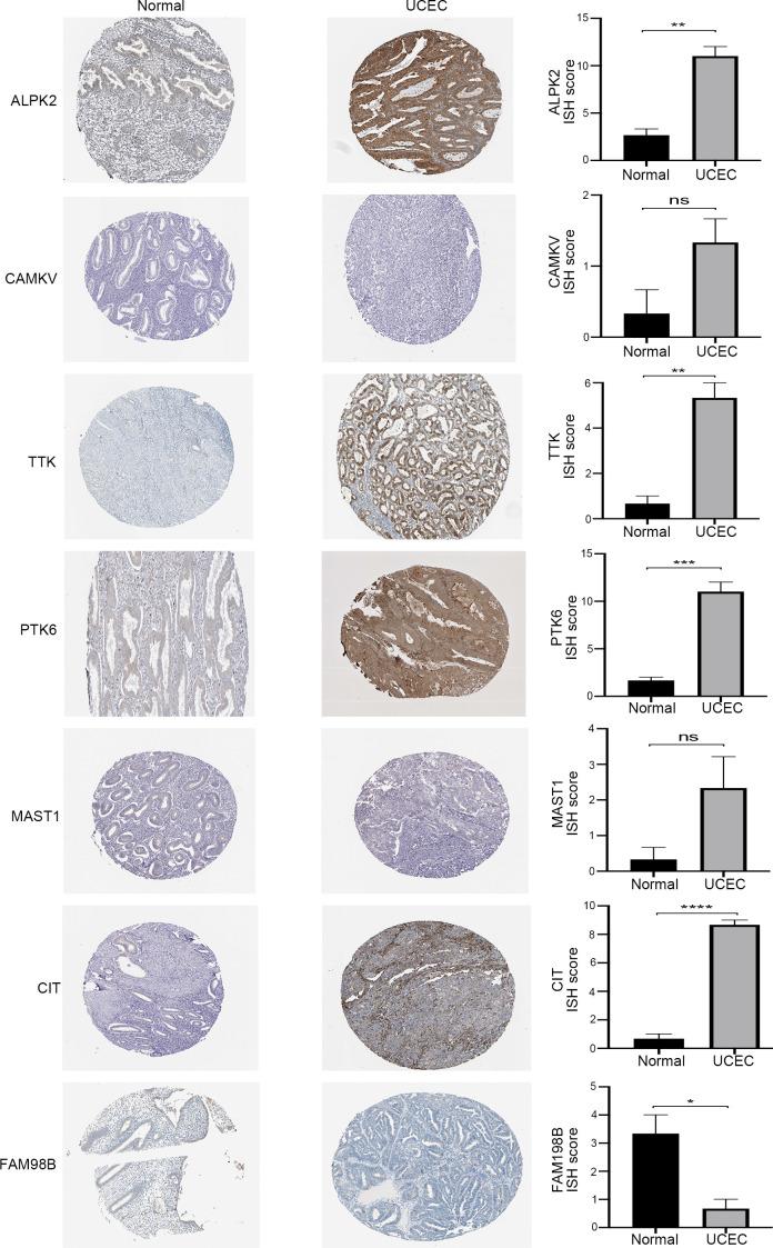 https://cdn.ncbi.nlm.nih.gov/pmc/blobs/fbcc/9491090/ece8bac6e830/fonc-12-944000-g007.jpg