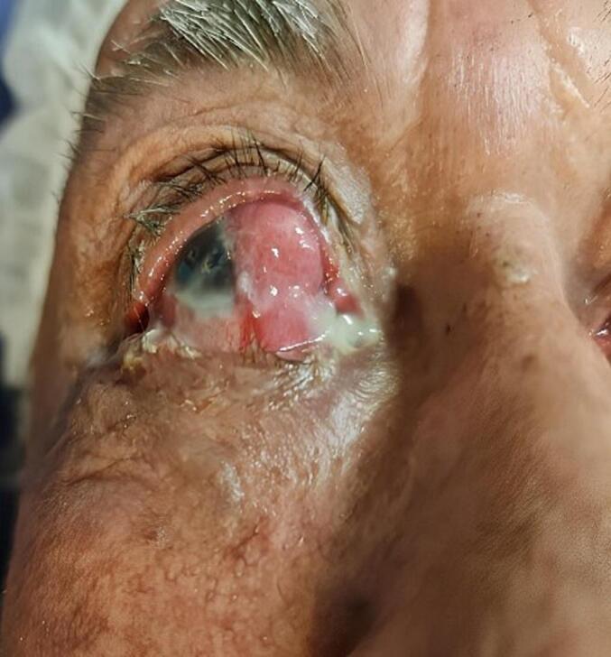 https://cdn.ncbi.nlm.nih.gov/pmc/blobs/fbce/11780152/db16fa17e6dd/gr1.jpg