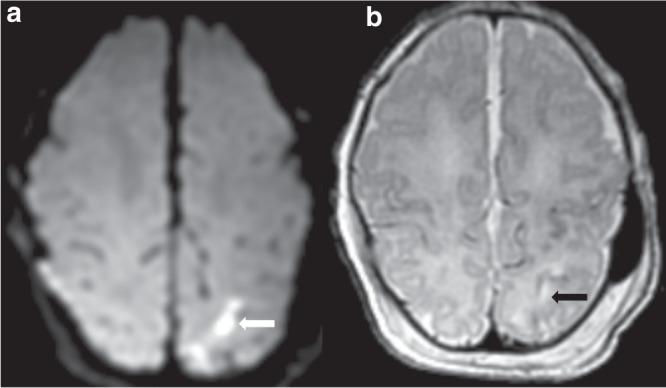 https://cdn.ncbi.nlm.nih.gov/pmc/blobs/fbce/9771796/8a04662b9283/41390_2022_2026_Fig2_HTML.jpg