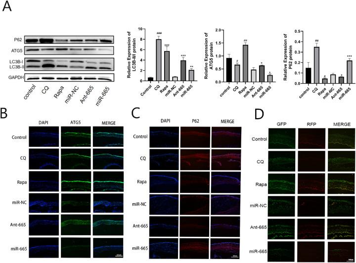https://cdn.ncbi.nlm.nih.gov/pmc/blobs/fbd5/7838549/2c4bf45a5d14/iovs-62-1-24-f004.jpg