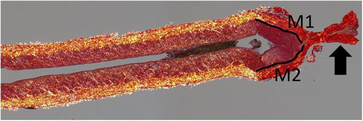 https://cdn.ncbi.nlm.nih.gov/pmc/blobs/fbdb/11776930/9c69cd46fdd7/MDER-18-75-g0002.jpg