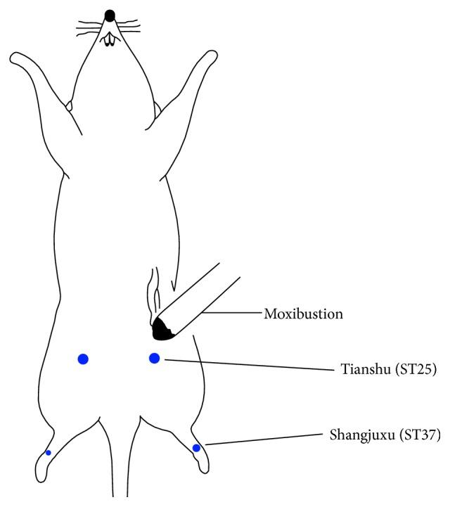 https://cdn.ncbi.nlm.nih.gov/pmc/blobs/fbdf/4855029/c8ed65874cc9/ECAM2016-3174608.001.jpg