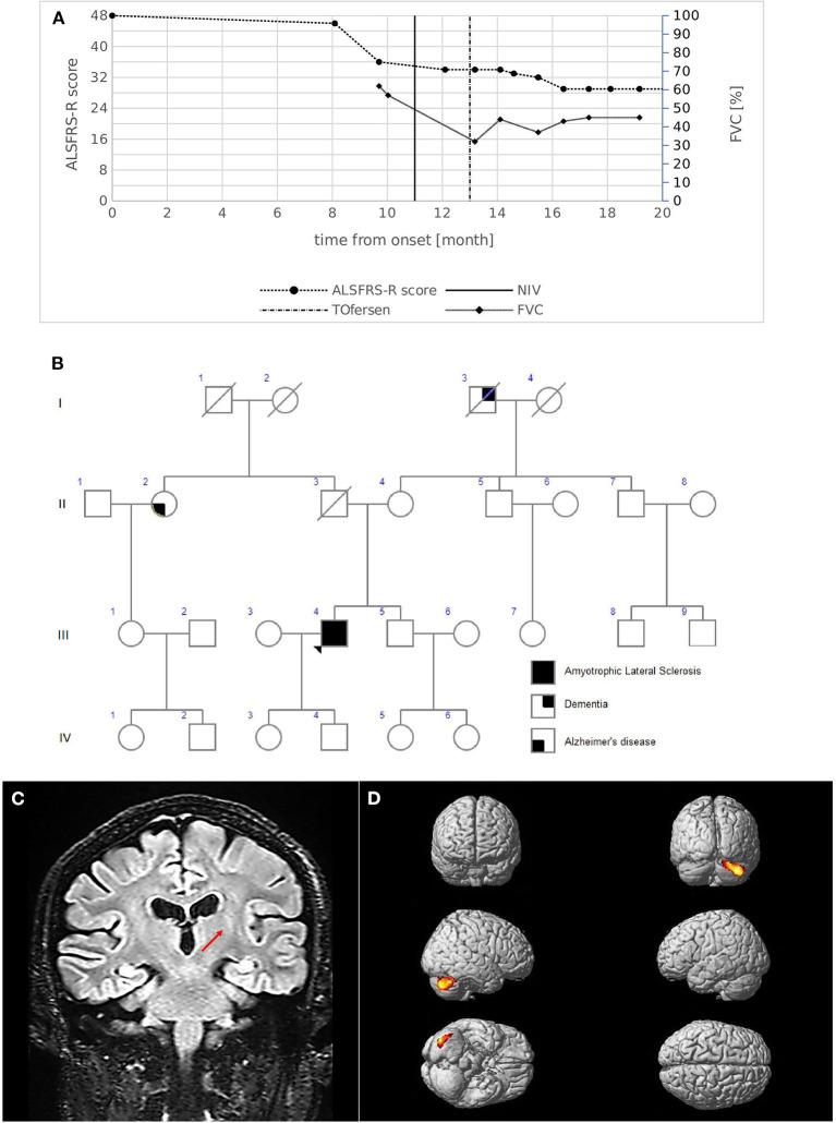 https://cdn.ncbi.nlm.nih.gov/pmc/blobs/fbdf/9846158/97bac3a06209/fneur-13-1052341-g0002.jpg