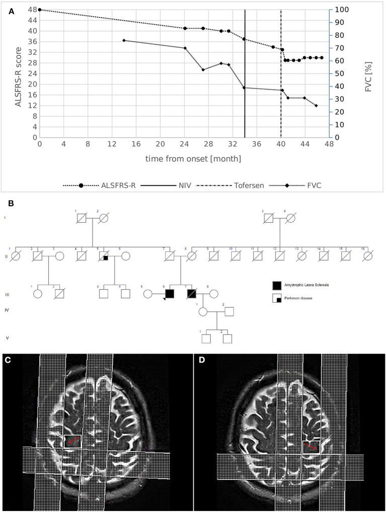 https://cdn.ncbi.nlm.nih.gov/pmc/blobs/fbdf/9846158/ea2f1c722975/fneur-13-1052341-g0001.jpg