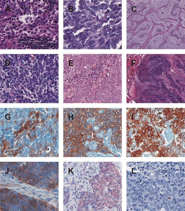 https://cdn.ncbi.nlm.nih.gov/pmc/blobs/fbe3/4078982/12ae740a0565/1746-1596-9-116-1.jpg