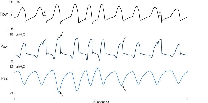 https://cdn.ncbi.nlm.nih.gov/pmc/blobs/fbec/7417783/48f41d9c1b63/134_2020_6206_Fig1_HTML.jpg