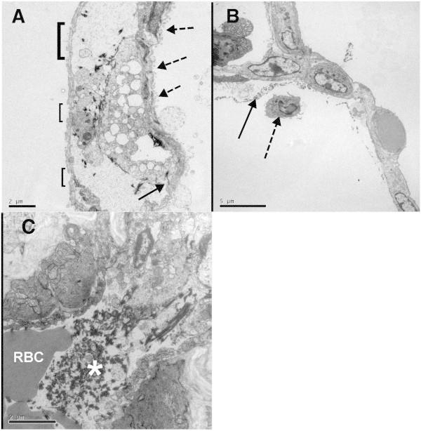 https://cdn.ncbi.nlm.nih.gov/pmc/blobs/fbed/4513039/94b73cb0ed78/40635_2013_7_Fig5_HTML.jpg