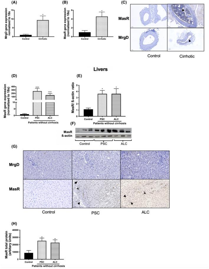 https://cdn.ncbi.nlm.nih.gov/pmc/blobs/fbee/9426402/25274007a37f/HEP4-6-2523-g007.jpg