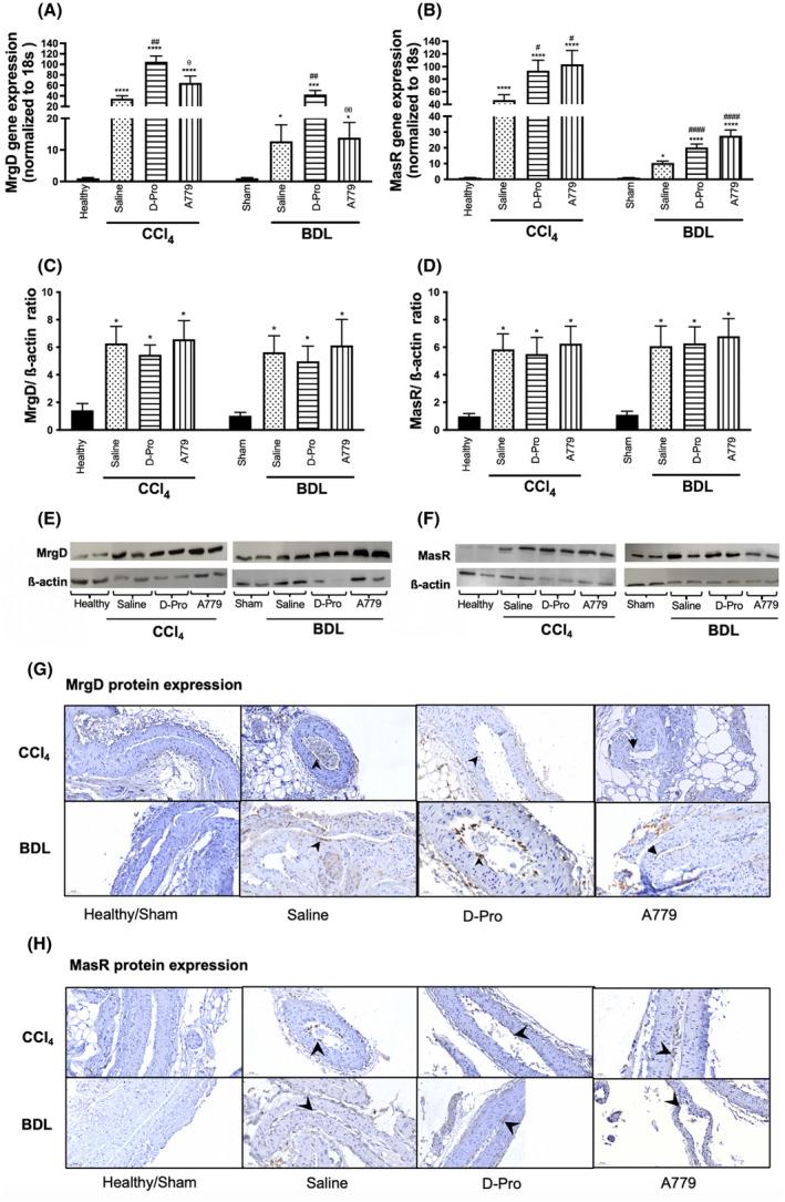 https://cdn.ncbi.nlm.nih.gov/pmc/blobs/fbee/9426402/6ca115aea623/HEP4-6-2523-g003.jpg