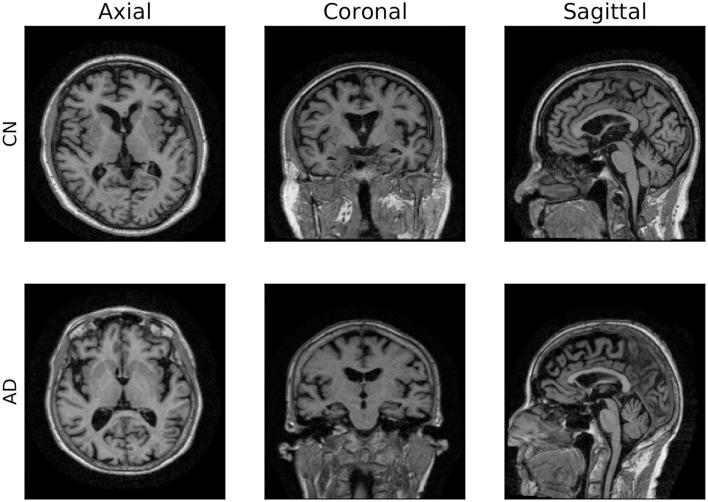 https://cdn.ncbi.nlm.nih.gov/pmc/blobs/fbf4/11451303/4cd3633076ed/fncom-18-1360095-g0001.jpg