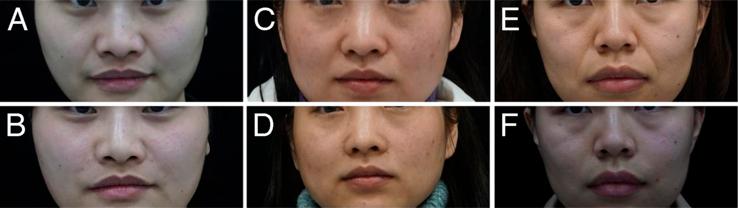 https://cdn.ncbi.nlm.nih.gov/pmc/blobs/fbf4/12020391/5a739c440a51/scs-36-0966-g004.jpg