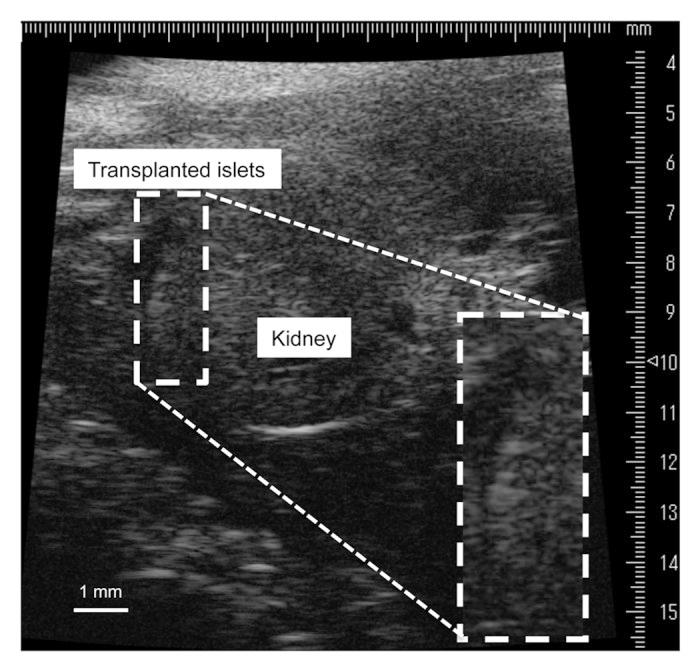 https://cdn.ncbi.nlm.nih.gov/pmc/blobs/fbf7/4010569/aedb22a2282d/isl-5-179-g2.jpg