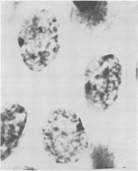 https://cdn.ncbi.nlm.nih.gov/pmc/blobs/fbf9/300057/0fb386ca6214/pnas00176-0113-a.jpg