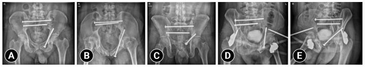 https://cdn.ncbi.nlm.nih.gov/pmc/blobs/fbfa/11309269/8e9357acf0e6/jti-2023-0002f4.jpg