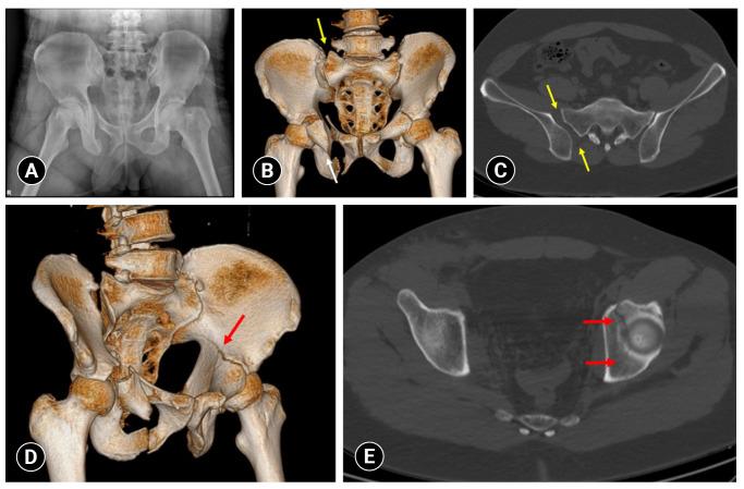 https://cdn.ncbi.nlm.nih.gov/pmc/blobs/fbfa/11309269/e2904c83ff62/jti-2023-0002f1.jpg