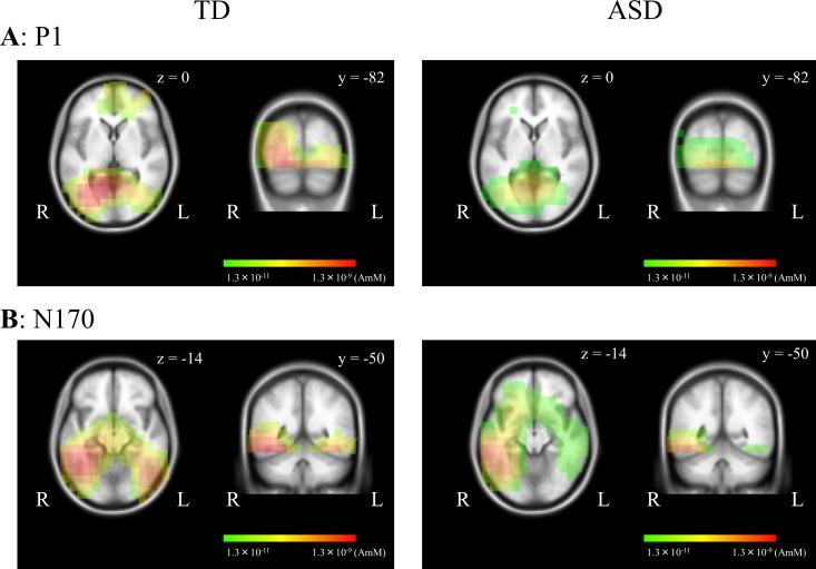 https://cdn.ncbi.nlm.nih.gov/pmc/blobs/fbfb/5287487/edcc85455cf3/pone.0170239.g006.jpg