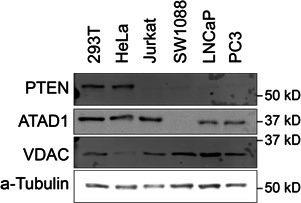 https://cdn.ncbi.nlm.nih.gov/pmc/blobs/fbfc/9815822/4d0d52052570/elife-82860-sa2-fig11.jpg