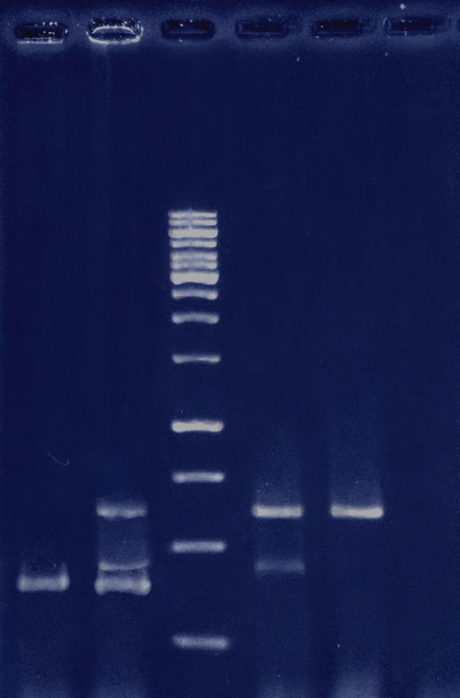 https://cdn.ncbi.nlm.nih.gov/pmc/blobs/fbfd/6358560/6349881ed3d5/ijp-13-429-g002.jpg