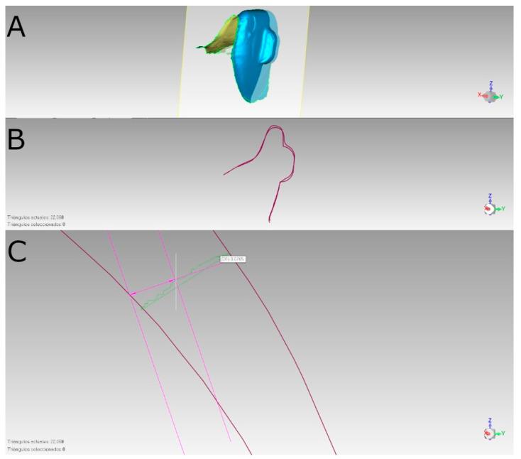 https://cdn.ncbi.nlm.nih.gov/pmc/blobs/fc08/11857747/00f41838fbf0/materials-18-00780-g003.jpg