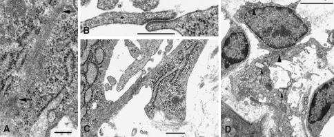 https://cdn.ncbi.nlm.nih.gov/pmc/blobs/fc0a/2413112/a965169a2681/418_2008_433_Fig6_HTML.jpg