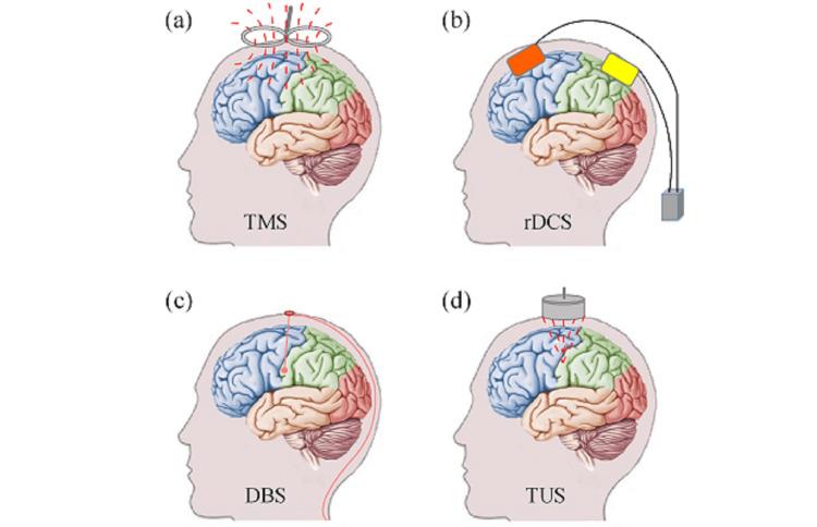 https://cdn.ncbi.nlm.nih.gov/pmc/blobs/fc0f/11995363/97a2e325da5e/cureus-0017-00000080447-i02.jpg