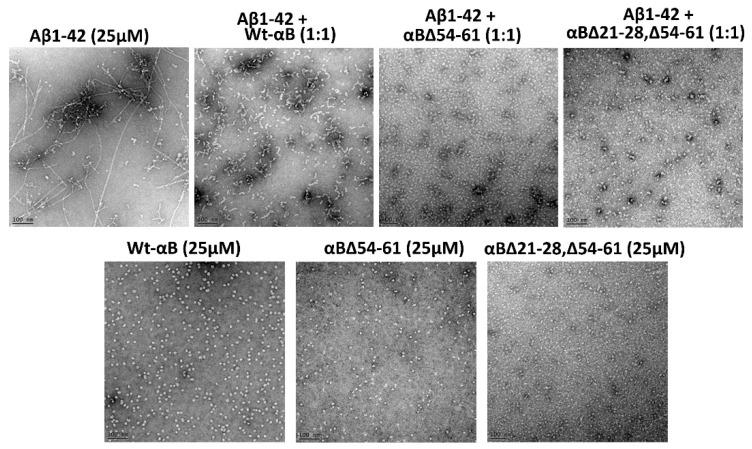 https://cdn.ncbi.nlm.nih.gov/pmc/blobs/fc14/8834691/5a32a34157fa/ijms-23-01099-g006.jpg