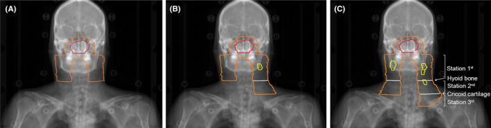 https://cdn.ncbi.nlm.nih.gov/pmc/blobs/fc15/10905225/5592ac0e3046/CAM4-13-e6723-g001.jpg