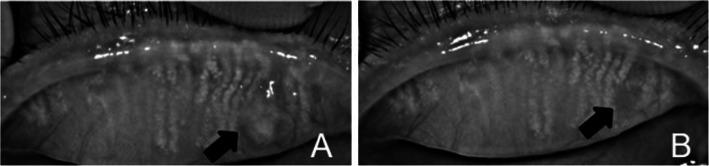 https://cdn.ncbi.nlm.nih.gov/pmc/blobs/fc15/7353760/ad616d2c902e/12886_2020_1557_Fig3_HTML.jpg