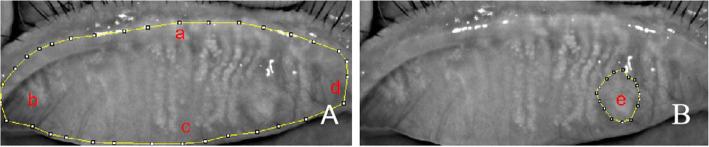 https://cdn.ncbi.nlm.nih.gov/pmc/blobs/fc15/7353760/d2f6d1fa4b78/12886_2020_1557_Fig1_HTML.jpg