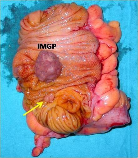 https://cdn.ncbi.nlm.nih.gov/pmc/blobs/fc18/2828397/8c4906a78452/1471-230X-10-10-2.jpg