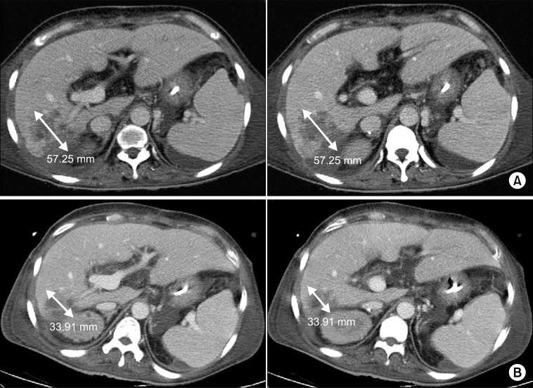 https://cdn.ncbi.nlm.nih.gov/pmc/blobs/fc1e/3467392/4367f2c22cc0/jkss-83-246-g002.jpg