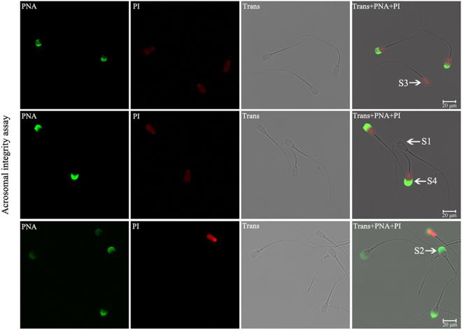 https://cdn.ncbi.nlm.nih.gov/pmc/blobs/fc26/5954094/0246c81b63c0/41598_2018_25687_Fig6_HTML.jpg