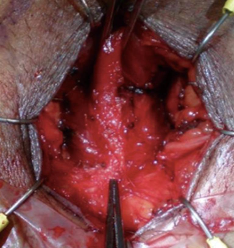 https://cdn.ncbi.nlm.nih.gov/pmc/blobs/fc27/5583049/dd545fa74f98/tau-06-04-666-f2.jpg