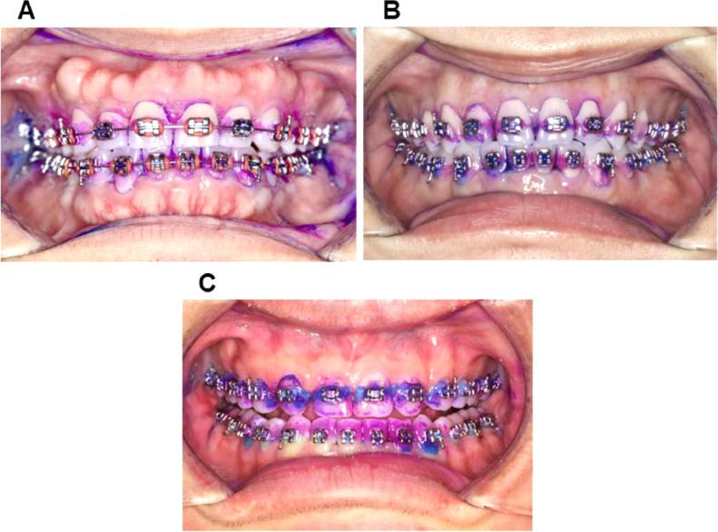 https://cdn.ncbi.nlm.nih.gov/pmc/blobs/fc28/9676514/571a4c14d2ce/gr1.jpg