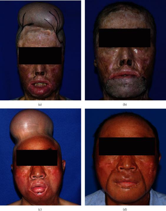 https://cdn.ncbi.nlm.nih.gov/pmc/blobs/fc29/9345714/0d5be956e81c/ABB2022-8564922.003.jpg